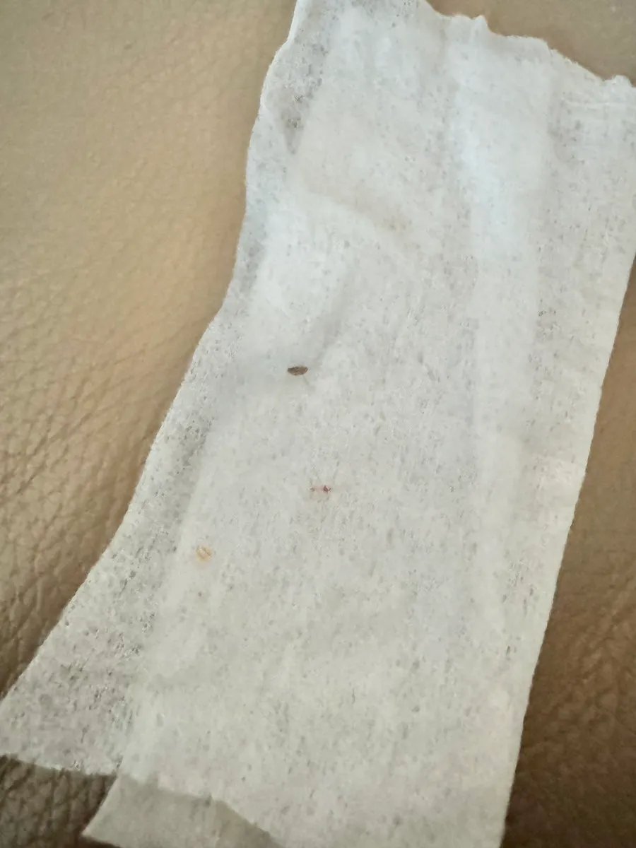 강아지 치석제거기, 집에서 안전하게 관리하는 방법 — 사진 13